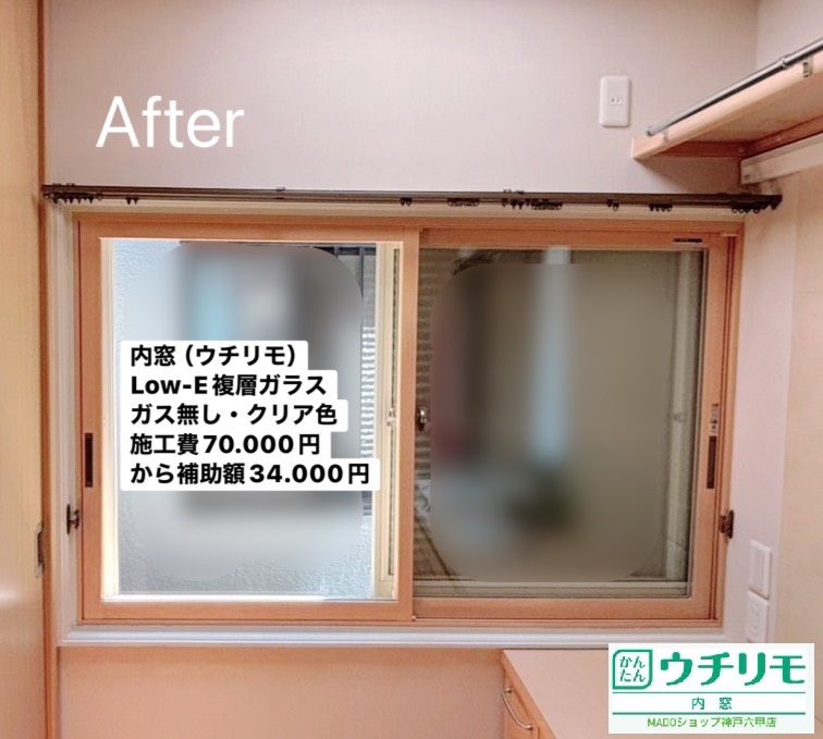 神戸市灘区　クリア色効果！？内窓を設置することで部屋の雰囲気が良くなった！【YKK APウチリモ設置】～先進的窓リノベ活用～